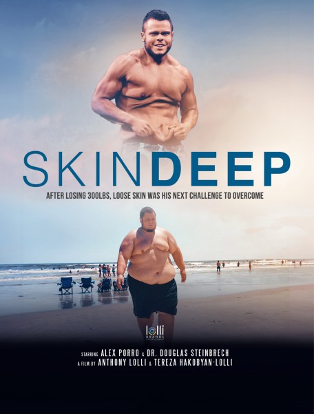 Behind the Scenes of Skin Deep & A Look at the Production