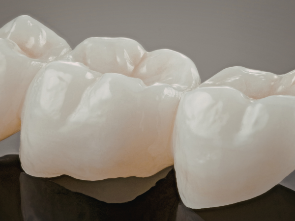 Radiant Smiles Dental Care Strengthens Crown Treatment Services Across Perth