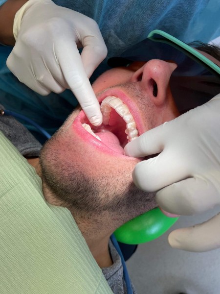 Totalcare Dental and Dermal Explores Cosmetic Dentistry Trends for Patients in Bondi Junction