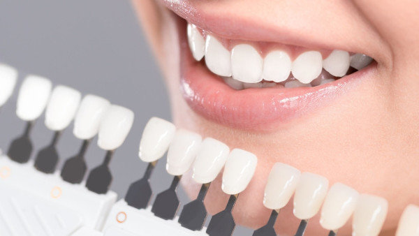 JC Dental Como Unveils Professional Teeth Whitening Solutions in Perth