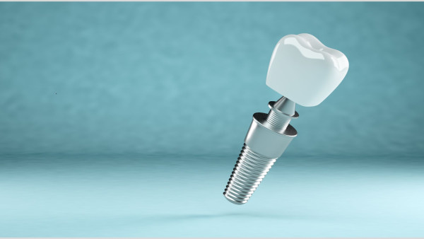 With U Dental Enhances Oral Health With Dental Implant Solutions in Melbourne