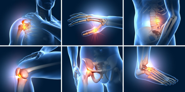 Managing Arthritis Pain Without Painkillers: Exploring Alternative Treatment Options