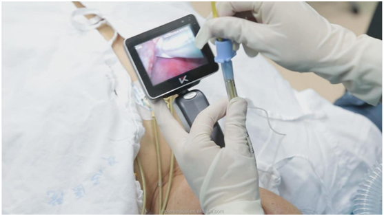 Dynamic Growth in Video Laryngoscope Sector An 2024 Overview