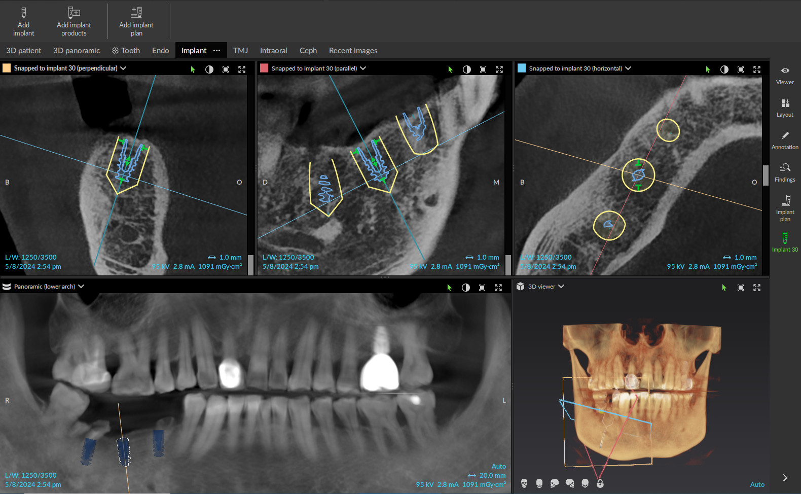 KYT Dental Services Introduces Advanced Dental Techniques to Improve Patient Outcomes